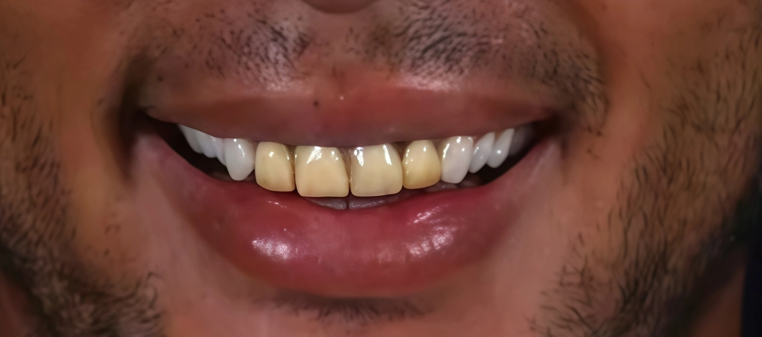 Antes do Tratamento Odontológico